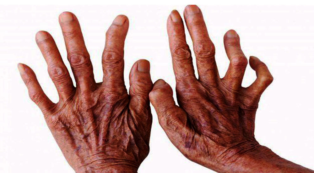 Tanahun taranga news